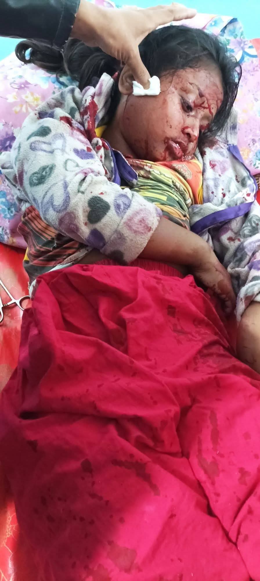 টেকনাফে গুলিবিদ্ধ শিশু আফনান চমেক হাসপাতালের আইসিইউতে